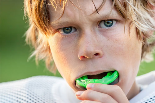 Protect Smiles During Fall Sports With Custom Mouthguards